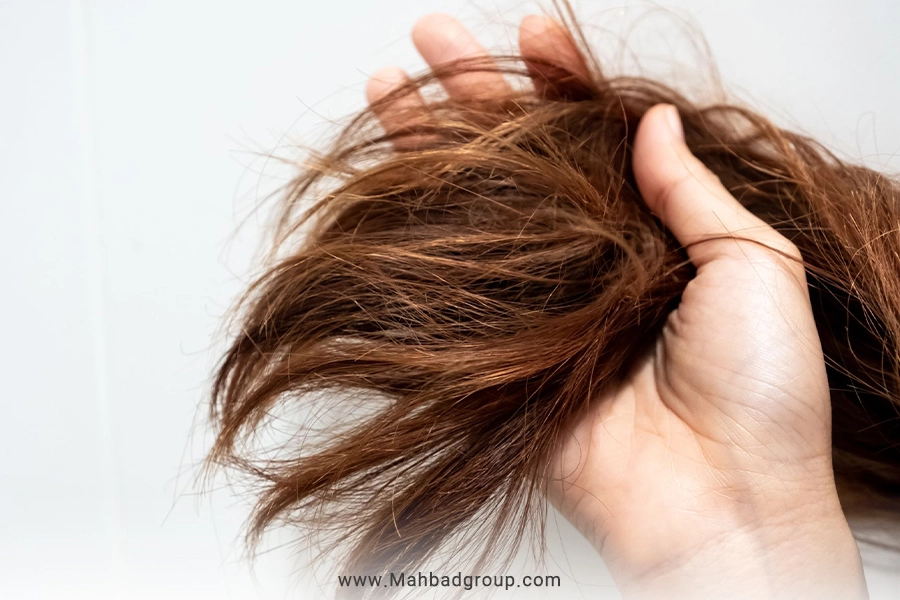 درمان موهای سوخته