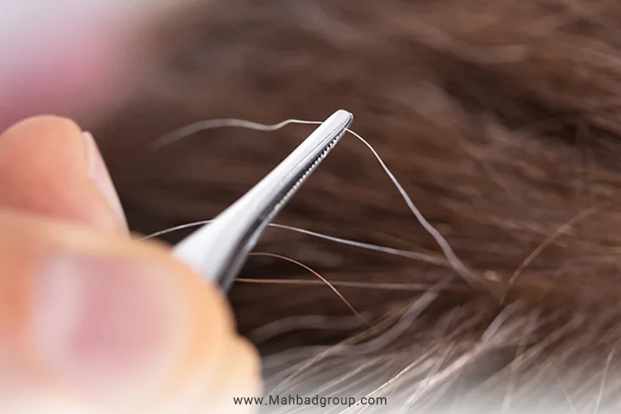 راهکار درمان سفیدی مو در سنین کم